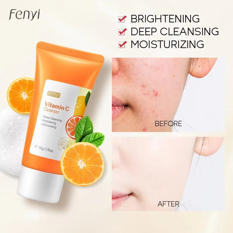 Vitamin C Foam Cleanser - Anti-Acne & Blackhead Removal